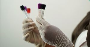 В Приангарье лаборатории не справляются с объемом тестов на коронавирус - Верблюд в огне